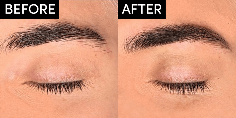 Microblading Eyebrows – INOA Beauty Hair and Beauty Treatments Salon in  London
