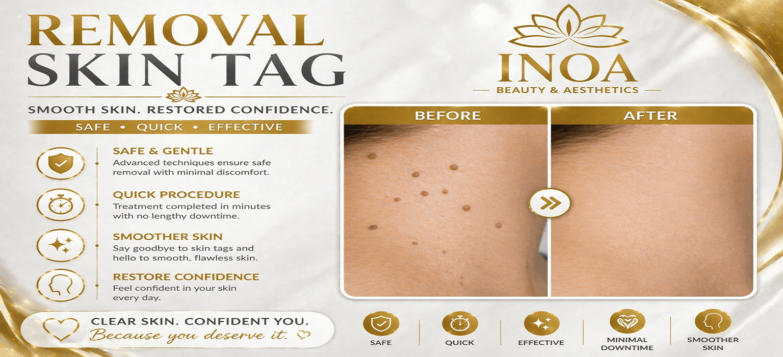 skintag_banner